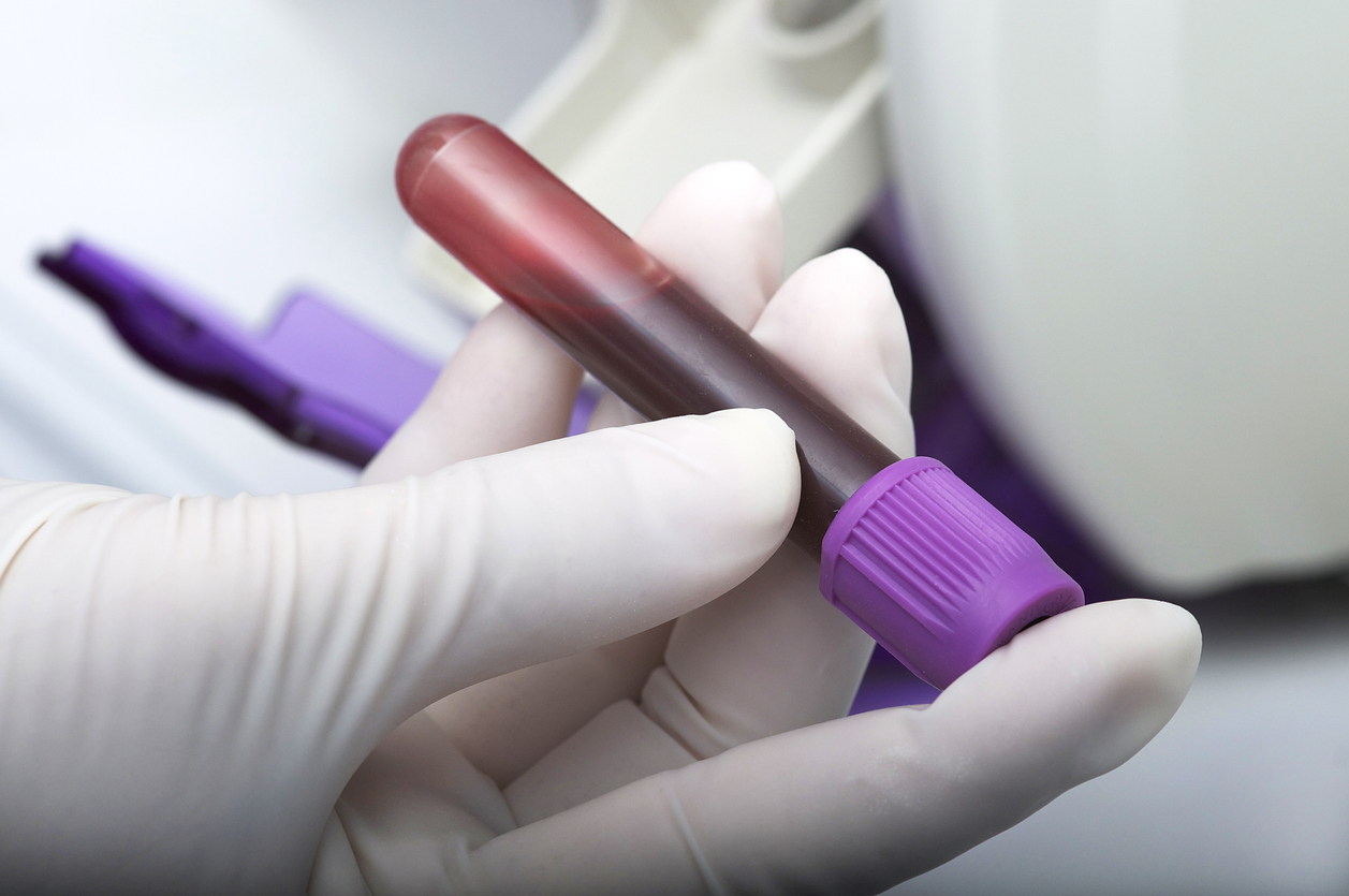 Inspection of blood testing company's labs reveals problems