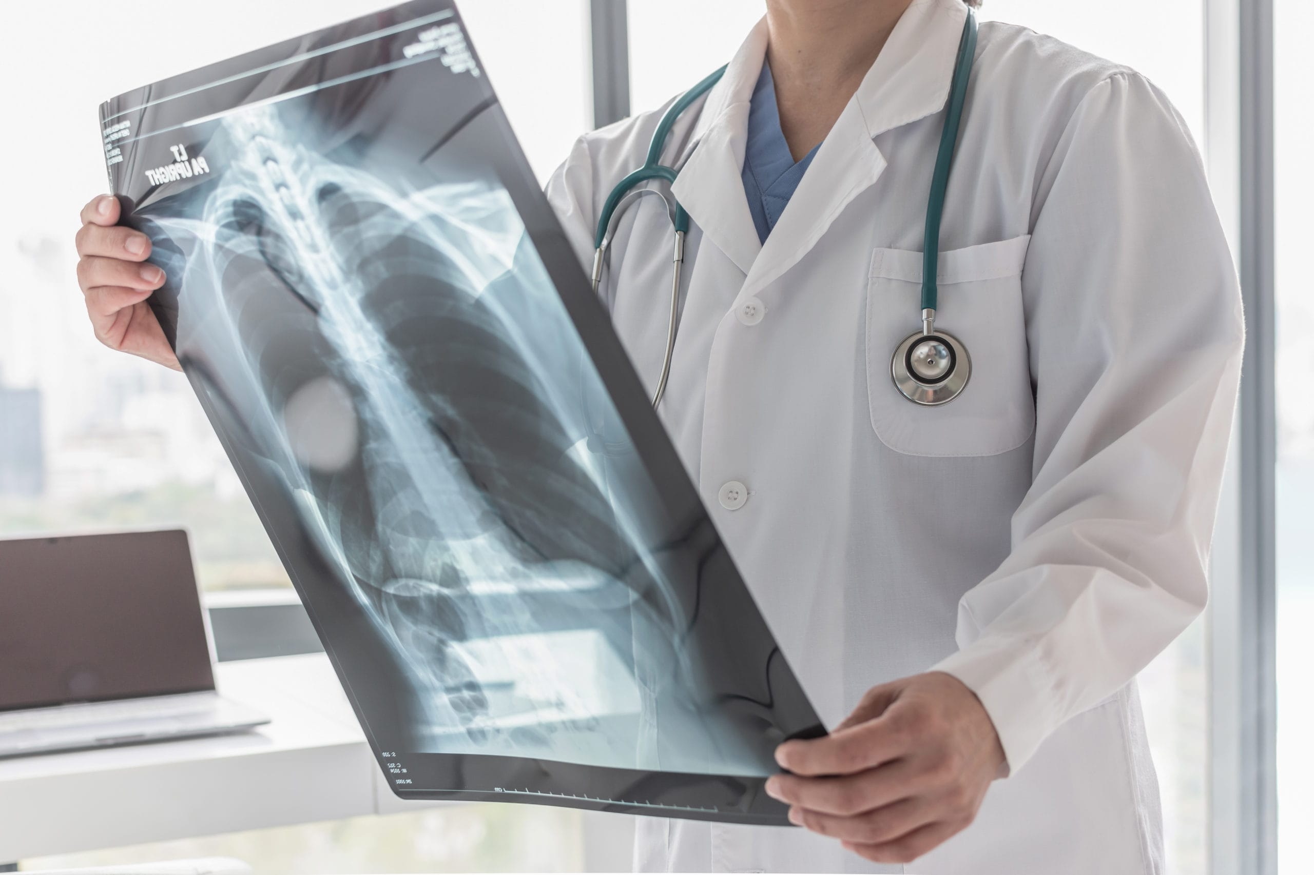 chest injuries