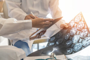 Síntomas de una hemorragia cerebral tras un traumatismo de cráneo