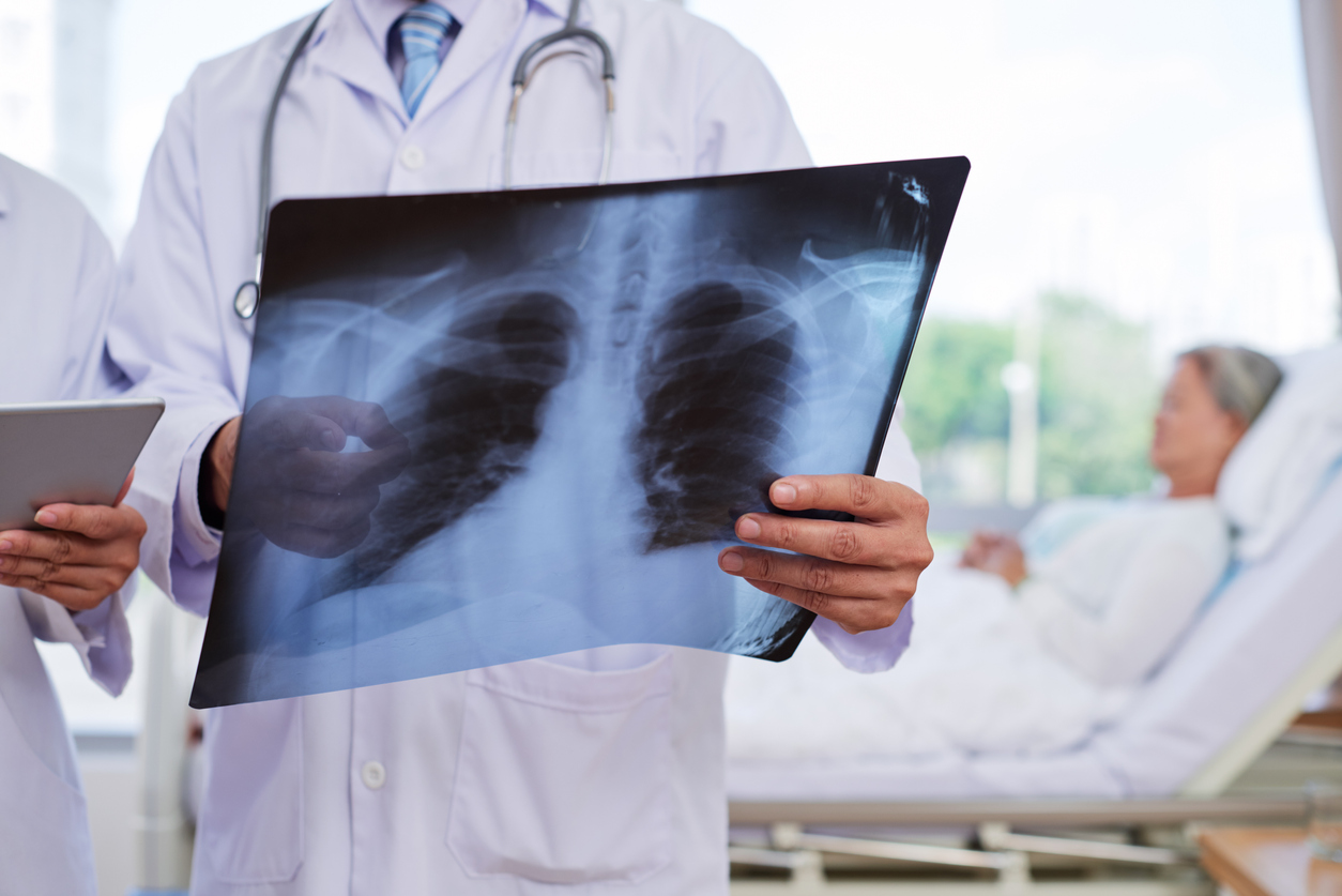 Symptoms of a Fractured Sternum